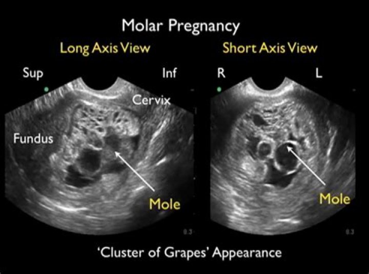 Brianna Keilar's Pregnancy And Its Profound Impact