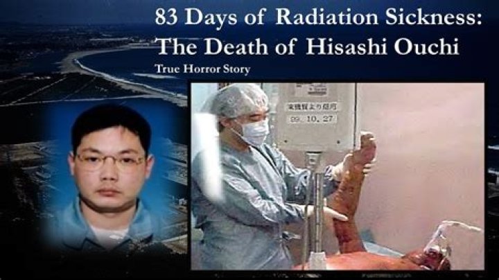 Hisashi Ouchi And Radiation's Legacy