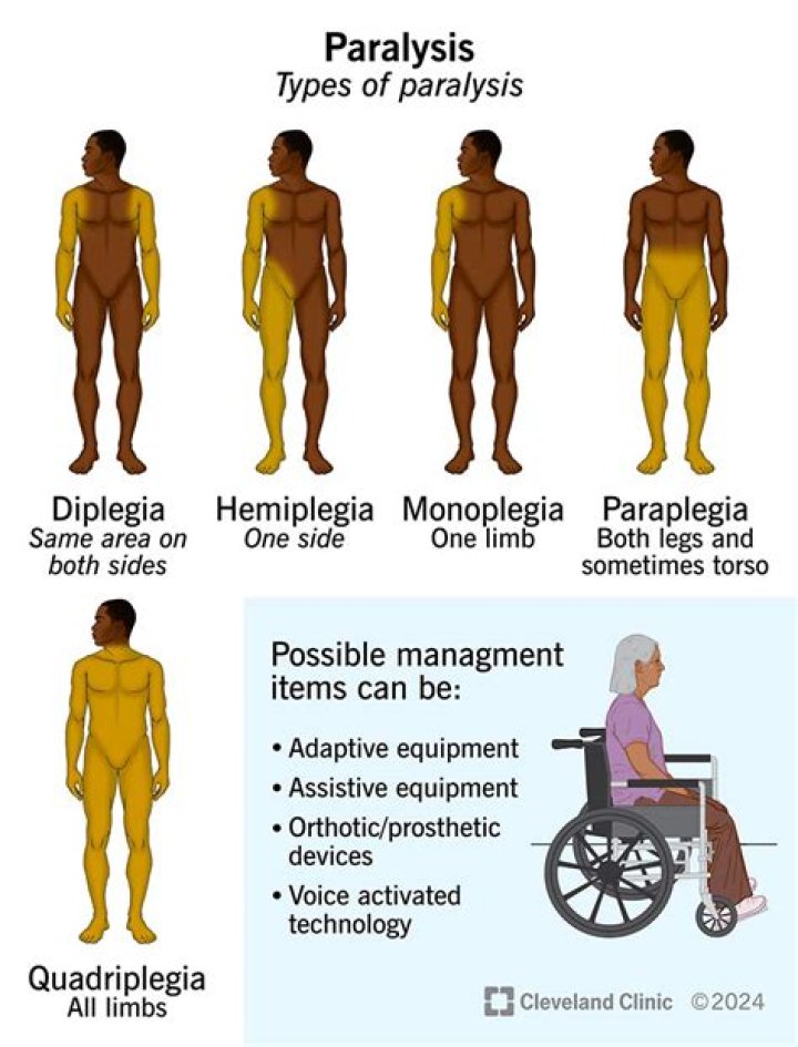 Is Mark Shields in a wheelchair? Wound that partially paralyzed him explained |