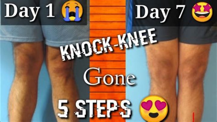 Knock Knees And The Stars
