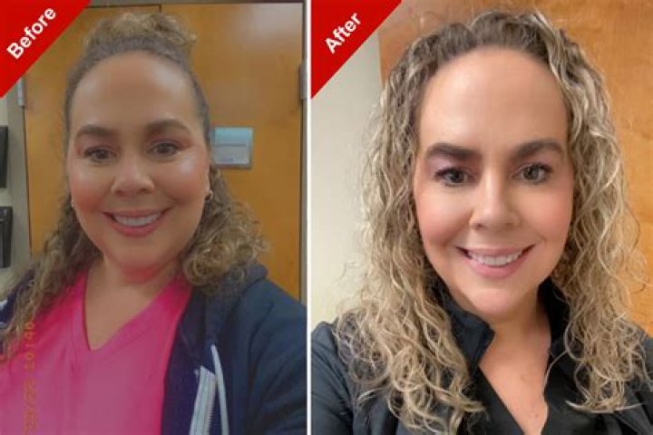 Sharyn Alfonsi Weight Loss: Check Her Before And After Photo