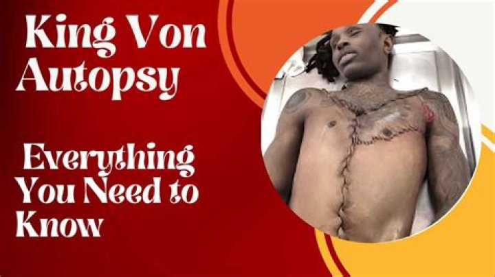 The Truth Behind King Von: Autopsy Reveals Shocking Details