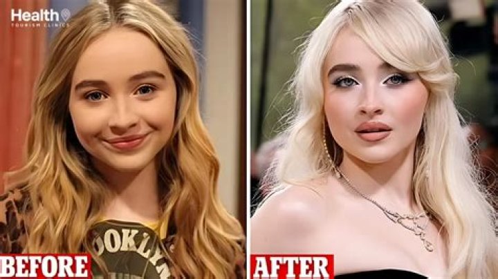 Unveiling Sabrina Carpenter's Plastic Surgery Journey
