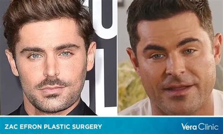 Zac Efron's new look triggers plastic surgery rumours: 'What did they do to his face?'